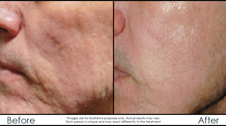 before-after-2-endy-en before-after-2-endy-en
