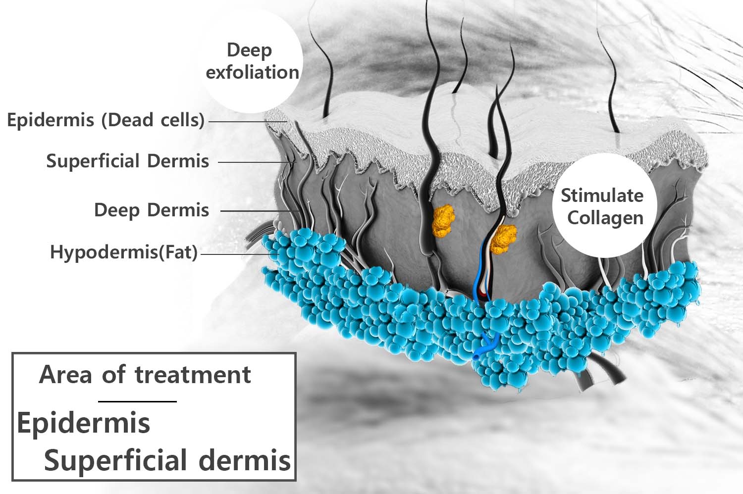chemical-peel chemical-peel