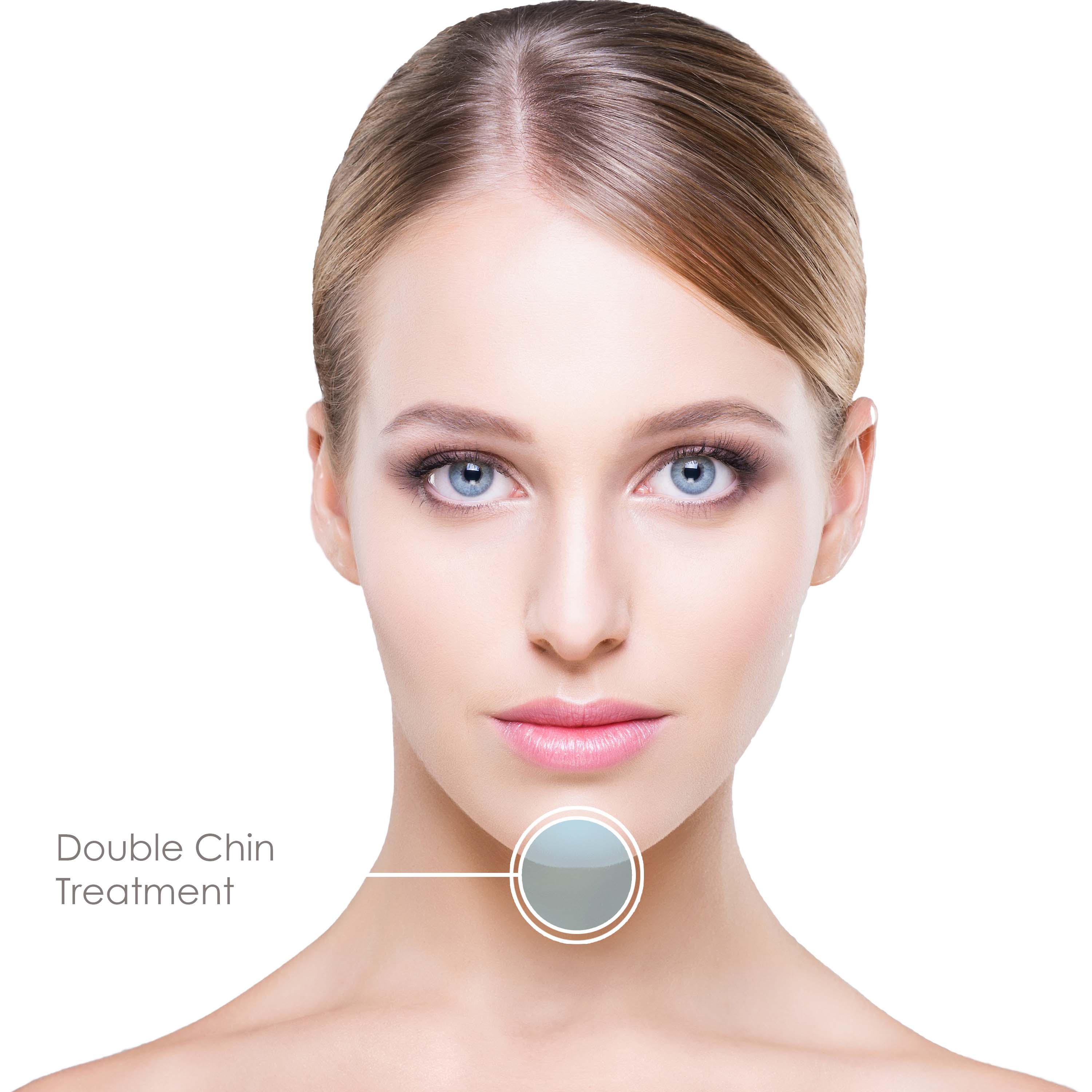 double-chin-treatment double-chin-treatment