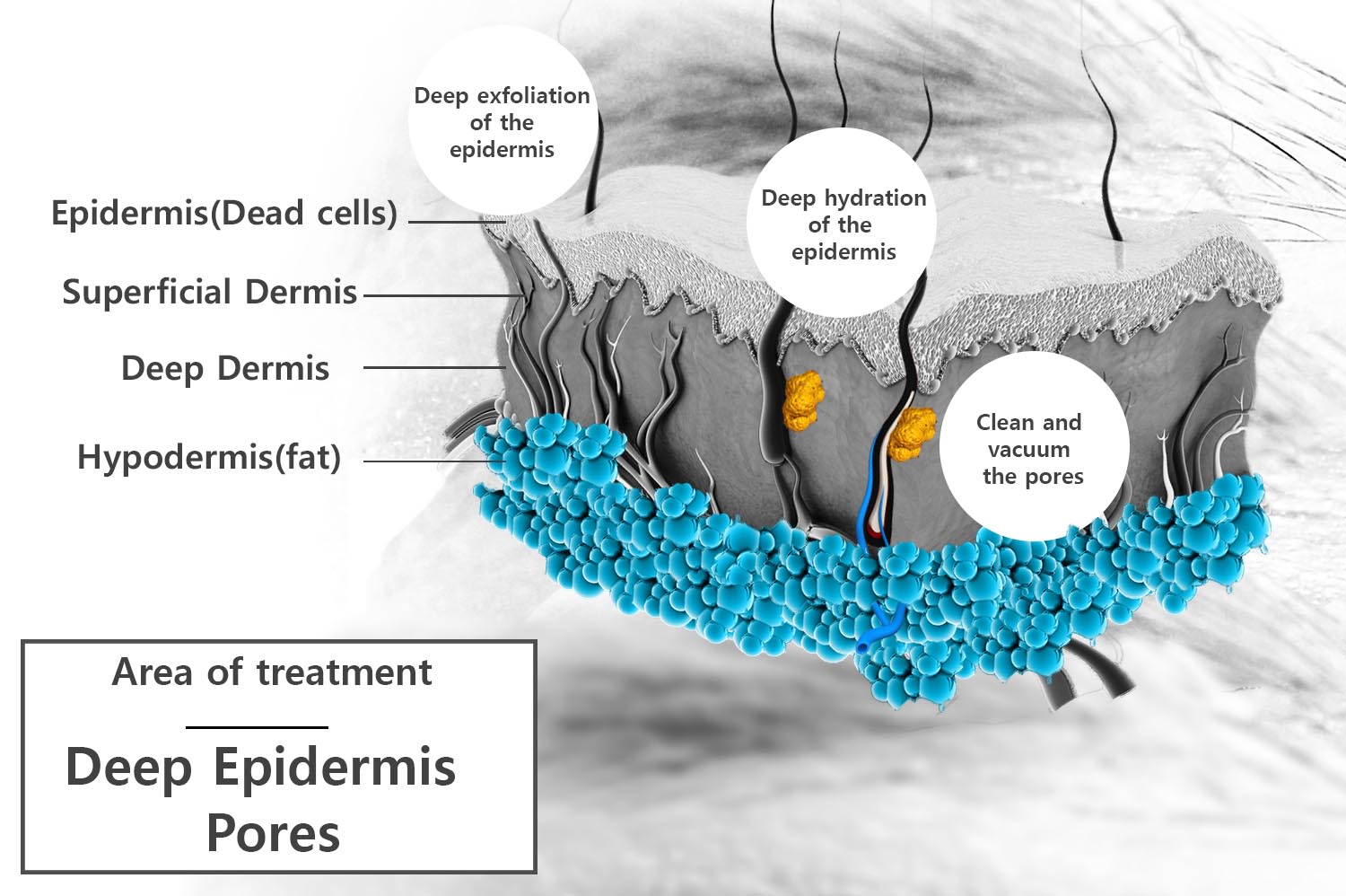 Hydrafacial MD Hydrafacial MD