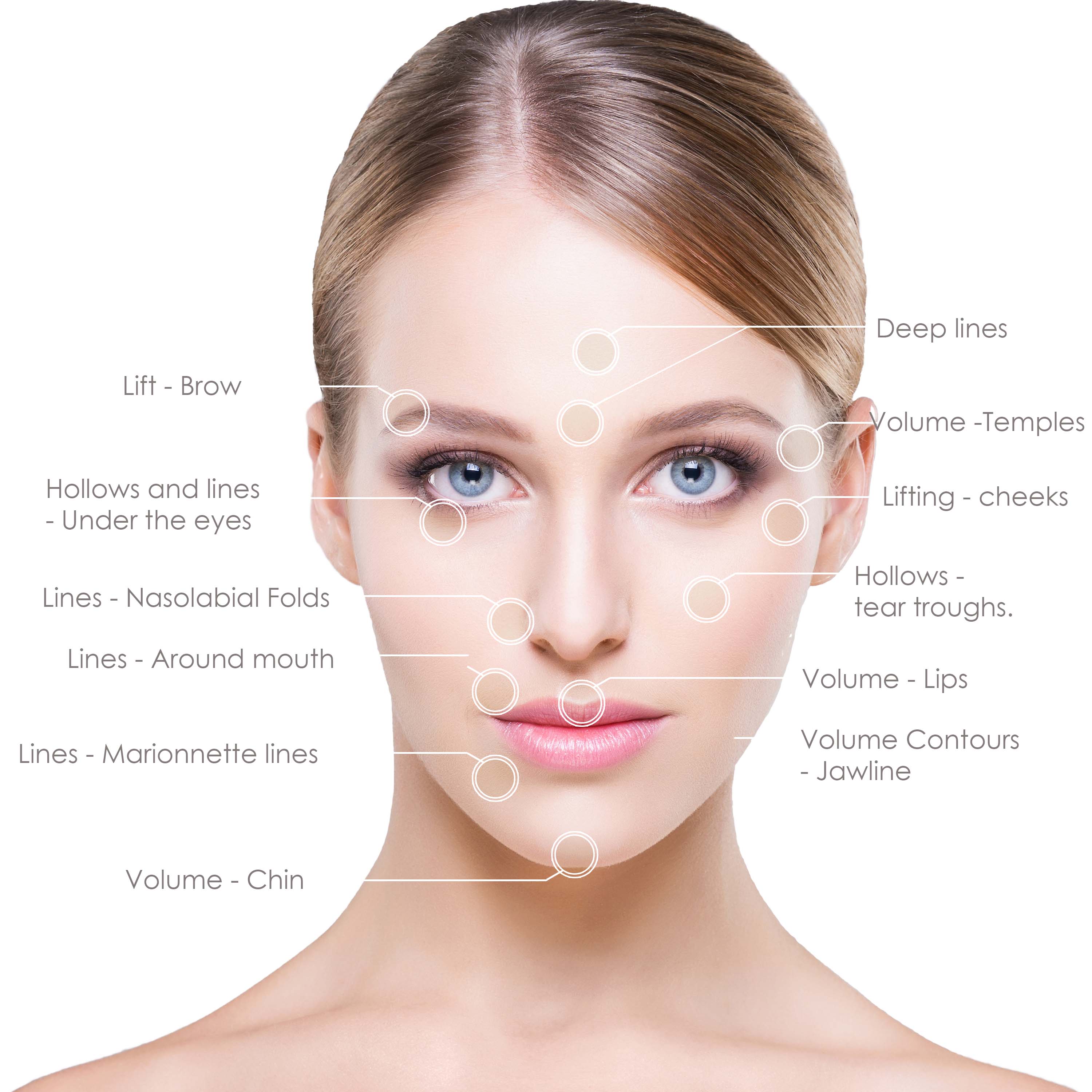 treatable-area-juvederm treatable-area-juvederm