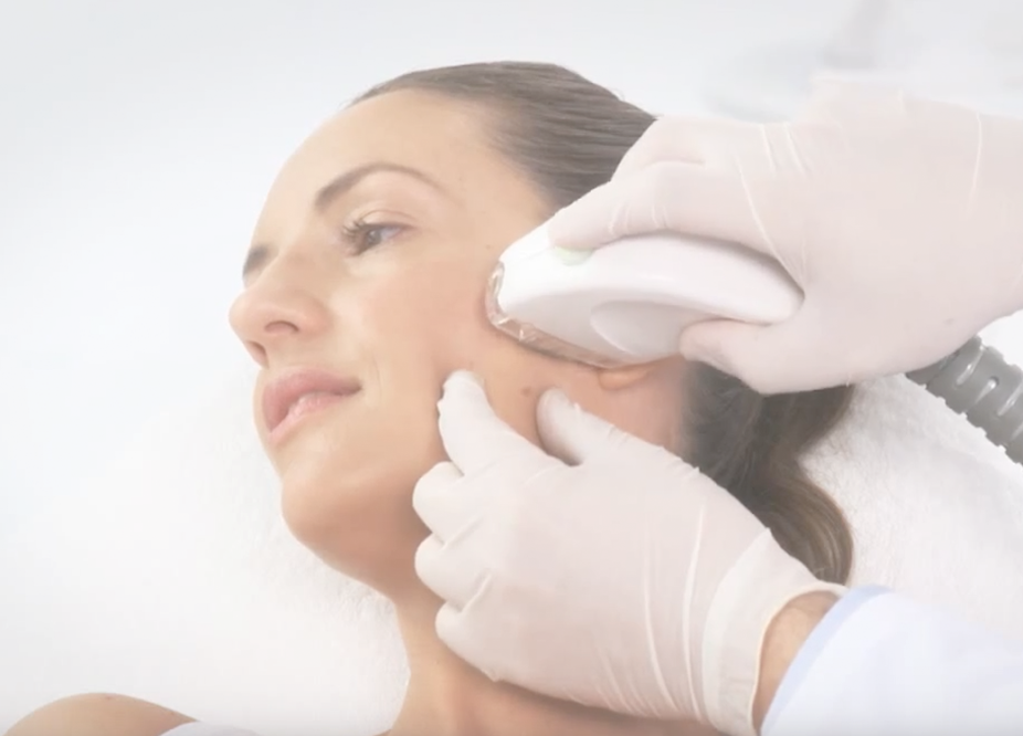 FSR- endymed- treatment FSR- endymed- treatment