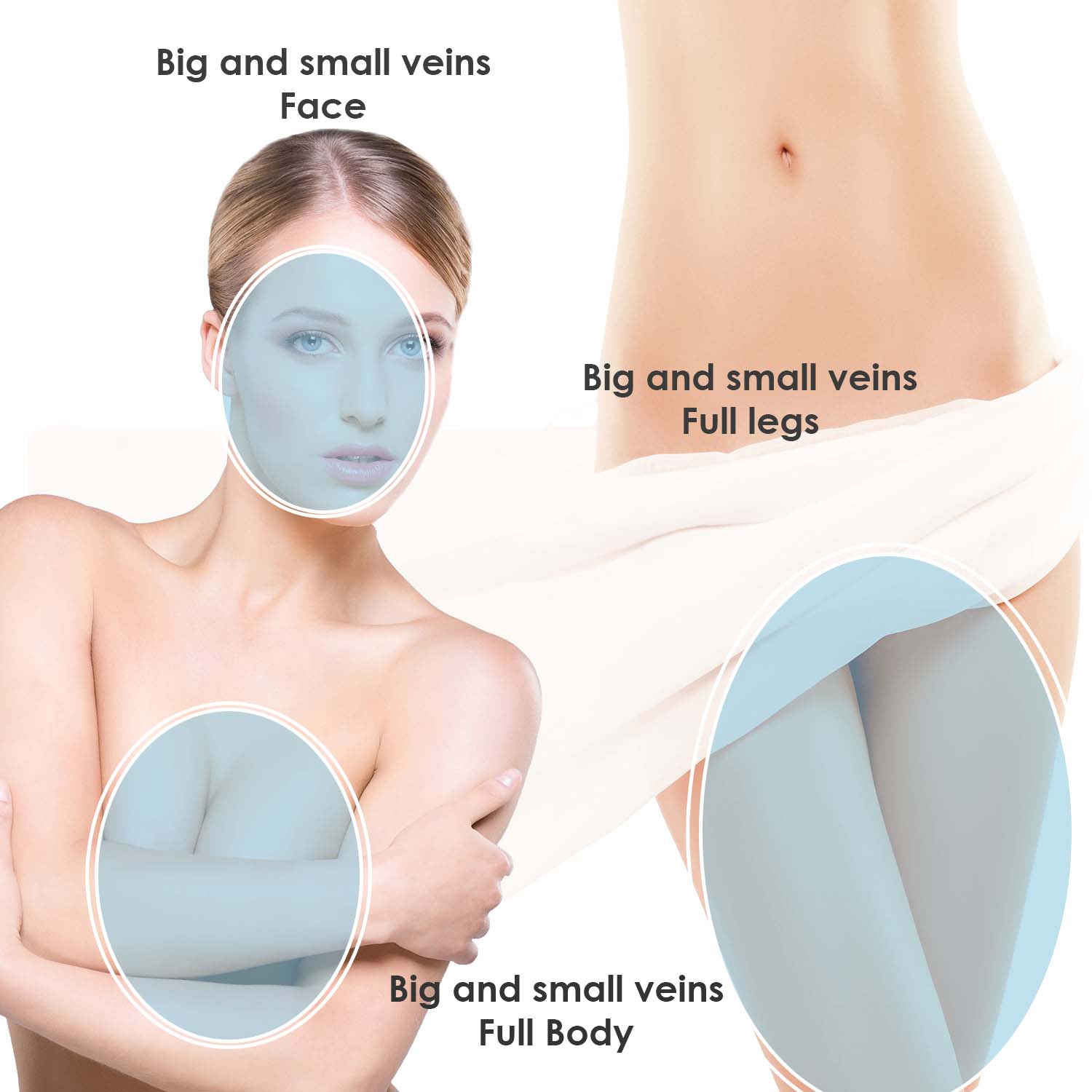 veins-treatment-big-small veins-treatment-big-small
