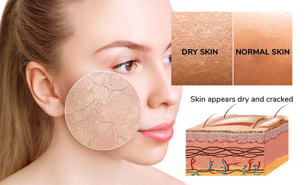 dryskin dryskin