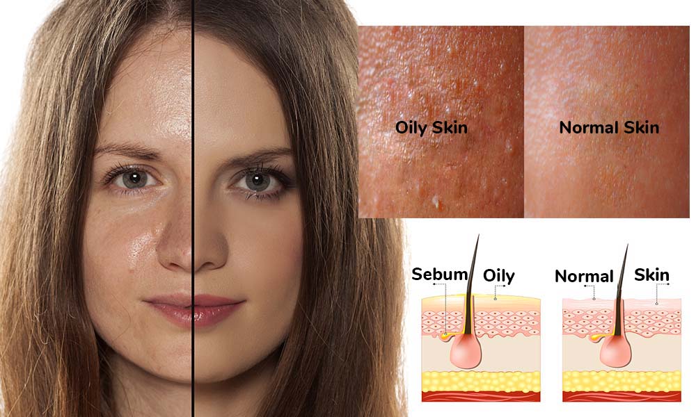 oilyskin oilyskin
