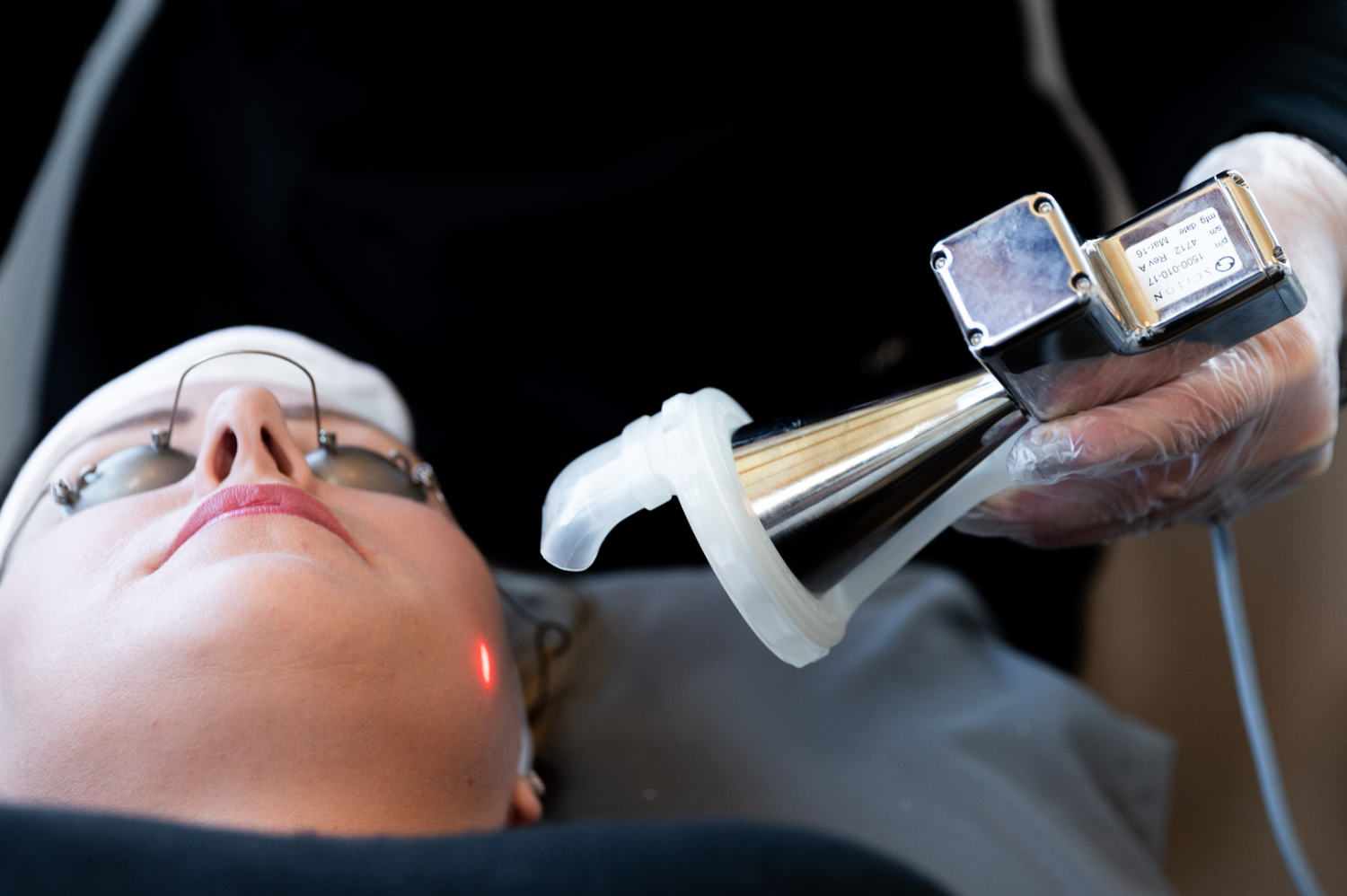 Laser resurfaçage fractionné Laser resurfaçage fractionné