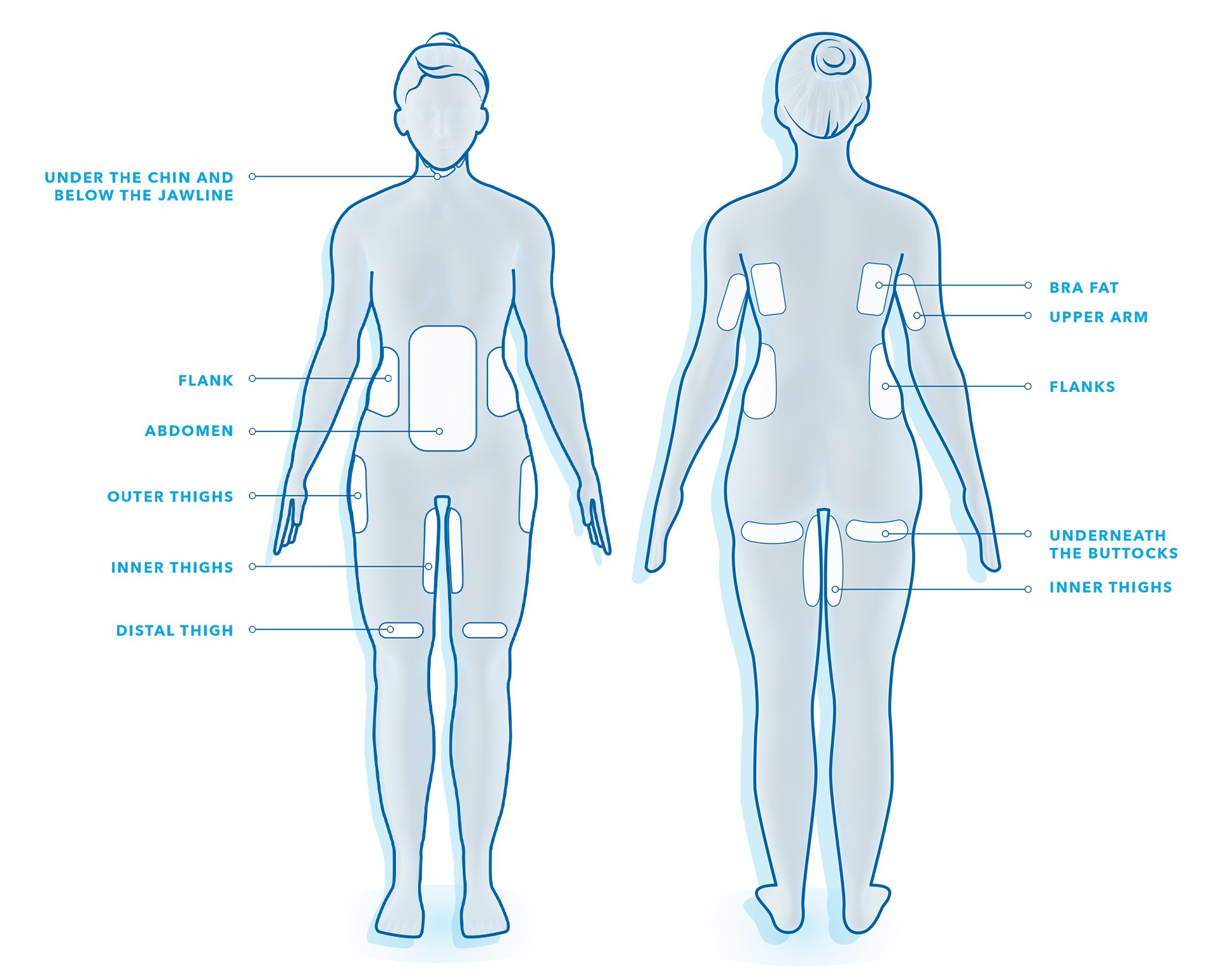 coolsculptingc2ae20treatment20areas20illustration2c20vertical